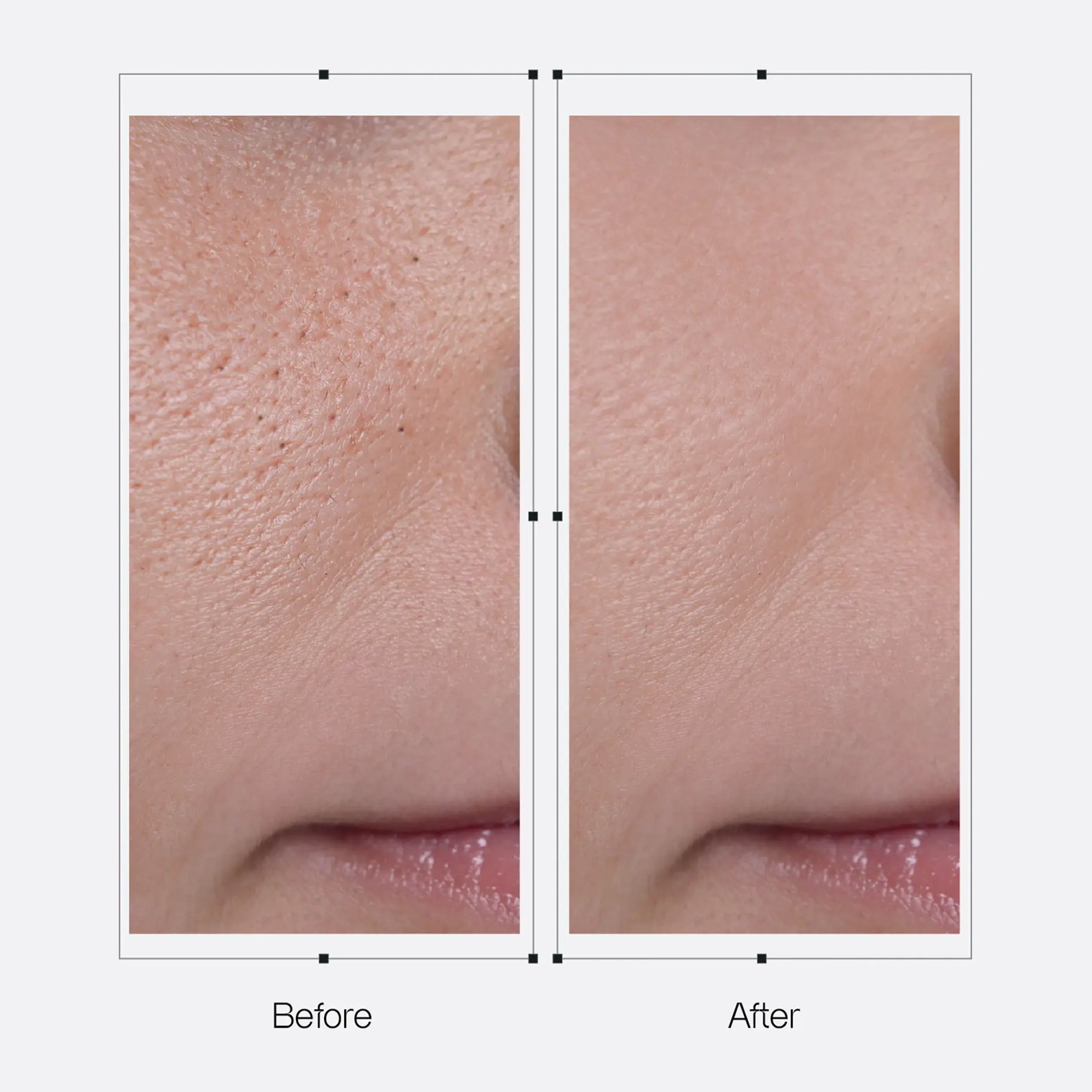 Derx™ Cleanser